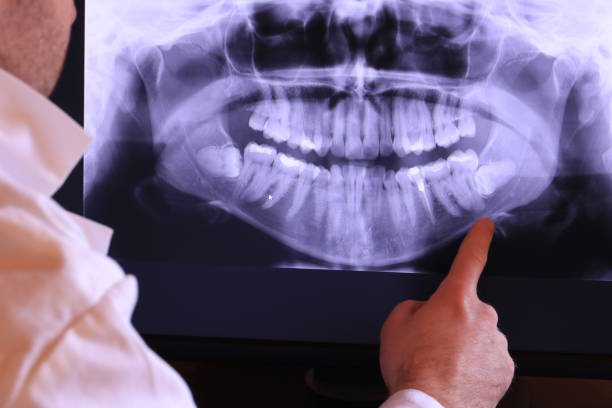 Best Broken or Chipped Tooth Repair in Braska City, NE