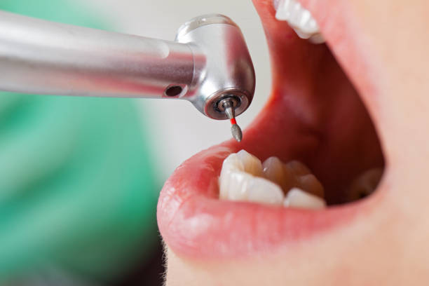 Best Dental Abscess Treatment in Braska City, NE